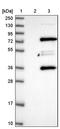 Membrane Palmitoylated Protein 7 antibody, PA5-58030, Invitrogen Antibodies, Western Blot image 