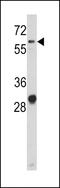 Activated Leukocyte Cell Adhesion Molecule antibody, MBS9213892, MyBioSource, Western Blot image 