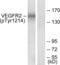 Kinase Insert Domain Receptor antibody, abx012572, Abbexa, Western Blot image 
