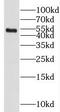 Histone-lysine N-methyltransferase SETD7 antibody, FNab07769, FineTest, Western Blot image 