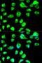 DNA Ligase 3 antibody, LS-B14872, Lifespan Biosciences, Immunofluorescence image 
