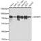 Insulin Like Growth Factor 2 MRNA Binding Protein 3 antibody, 18-802, ProSci, Western Blot image 