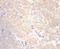 C-C Motif Chemokine Ligand 24 antibody, MBS719906, MyBioSource, Immunohistochemistry paraffin image 