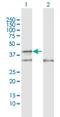 Cytochrome C Oxidase Assembly Factor Heme A:Farnesyltransferase COX10 antibody, H00001352-D01P, Novus Biologicals, Western Blot image 