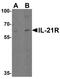Interleukin 21 Receptor antibody, NBP1-76739, Novus Biologicals, Western Blot image 