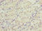 DNA Damage Inducible Transcript 3 antibody, LS-C396270, Lifespan Biosciences, Immunohistochemistry paraffin image 