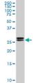 High Mobility Group Box 2 antibody, H00003148-M05, Novus Biologicals, Western Blot image 