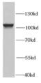 Proteasome 26S Subunit, Non-ATPase 2 antibody, FNab06887, FineTest, Western Blot image 