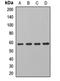 Aldehyde Dehydrogenase 7 Family Member A1 antibody, LS-C667706, Lifespan Biosciences, Western Blot image 