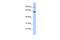 Atlastin GTPase 3 antibody, GTX46355, GeneTex, Western Blot image 
