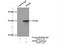 Phosphomannomutase 2 antibody, 10666-1-AP, Proteintech Group, Immunoprecipitation image 