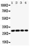 Major Histocompatibility Complex, Class II, DM Beta antibody, PA5-79368, Invitrogen Antibodies, Western Blot image 