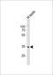 Myeloid Leukemia Factor 1 antibody, M06772-1, Boster Biological Technology, Western Blot image 