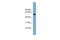 Actin Related Protein 10 antibody, GTX44939, GeneTex, Western Blot image 