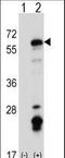 FYN Proto-Oncogene, Src Family Tyrosine Kinase antibody, LS-C164391, Lifespan Biosciences, Western Blot image 