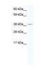 Transducer Of ERBB2, 1 antibody, NBP1-80225, Novus Biologicals, Western Blot image 