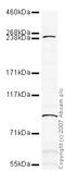 SET Domain Containing 2, Histone Lysine Methyltransferase antibody, ab31358, Abcam, Western Blot image 