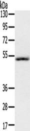 Interleukin 17 Receptor B antibody, TA351284, Origene, Western Blot image 