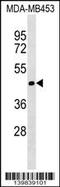 Translocase Of Inner Mitochondrial Membrane 50 antibody, 60-301, ProSci, Western Blot image 