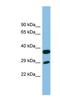 Receptor Transporter Protein 4 antibody, NBP1-56448, Novus Biologicals, Western Blot image 