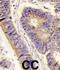Golgi Associated PDZ And Coiled-Coil Motif Containing antibody, abx033276, Abbexa, Immunohistochemistry paraffin image 