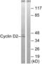 Cyclin D2 antibody, abx012975, Abbexa, Western Blot image 