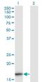 Interleukin 36 Beta antibody, H00027177-M01, Novus Biologicals, Western Blot image 