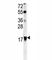 ADP Ribosylation Factor 1 antibody, F49371-0.4ML, NSJ Bioreagents, Western Blot image 