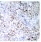 p53 antibody, AP01661PU-N, Origene, Immunohistochemistry frozen image 