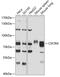 Colony Stimulating Factor 2 Receptor Alpha Subunit antibody, 18-458, ProSci, Western Blot image 