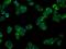 Natriuretic Peptide Receptor 3 antibody, MA5-25079, Invitrogen Antibodies, Immunocytochemistry image 