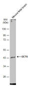 POU Class 3 Homeobox 1 antibody, GTX134063, GeneTex, Western Blot image 