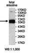 Protein Inhibitor Of Activated STAT 3 antibody, orb78095, Biorbyt, Western Blot image 