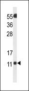 SH3 Domain Binding Glutamate Rich Protein Like 3 antibody, LS-C169060, Lifespan Biosciences, Western Blot image 