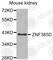 Zinc Finger Protein 385D antibody, A3497, ABclonal Technology, Western Blot image 