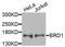 Bromodomain Containing 1 antibody, STJ111911, St John