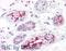 Lymphatic Vessel Endothelial Hyaluronan Receptor 1 antibody, 43-668, ProSci, Western Blot image 