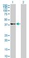 Cyclin Dependent Kinase 9 antibody, H00001025-M07, Novus Biologicals, Western Blot image 