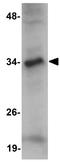Jumonji Domain Containing 7 antibody, GTX85250, GeneTex, Western Blot image 