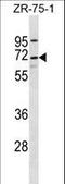 Twinkle protein, mitochondrial antibody, LS-C156913, Lifespan Biosciences, Western Blot image 