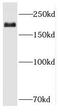 RB Binding Protein 6, Ubiquitin Ligase antibody, FNab07152, FineTest, Western Blot image 