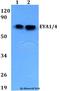EYA Transcriptional Coactivator And Phosphatase 1 antibody, A02376, Boster Biological Technology, Western Blot image 