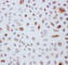 Peroxiredoxin 3 antibody, PA1836, Boster Biological Technology, Immunocytochemistry image 