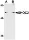 SHOC2 Leucine Rich Repeat Scaffold Protein antibody, orb75216, Biorbyt, Western Blot image 