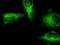 Gasdermin B antibody, H00055876-M05, Novus Biologicals, Immunofluorescence image 