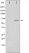 Serum/Glucocorticoid Regulated Kinase 1 antibody, TA325836, Origene, Western Blot image 