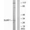 SURF1 Cytochrome C Oxidase Assembly Factor antibody, PA5-49828, Invitrogen Antibodies, Western Blot image 