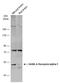 Gamma-Aminobutyric Acid Type A Receptor Alpha1 Subunit antibody, GTX133147, GeneTex, Western Blot image 