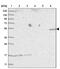 EPS8 Like 3 antibody, PA5-56611, Invitrogen Antibodies, Western Blot image 