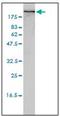 Filamin A antibody, AM31790PU-N, Origene, Western Blot image 